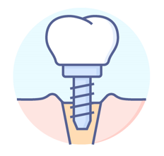 icono implantes dentales