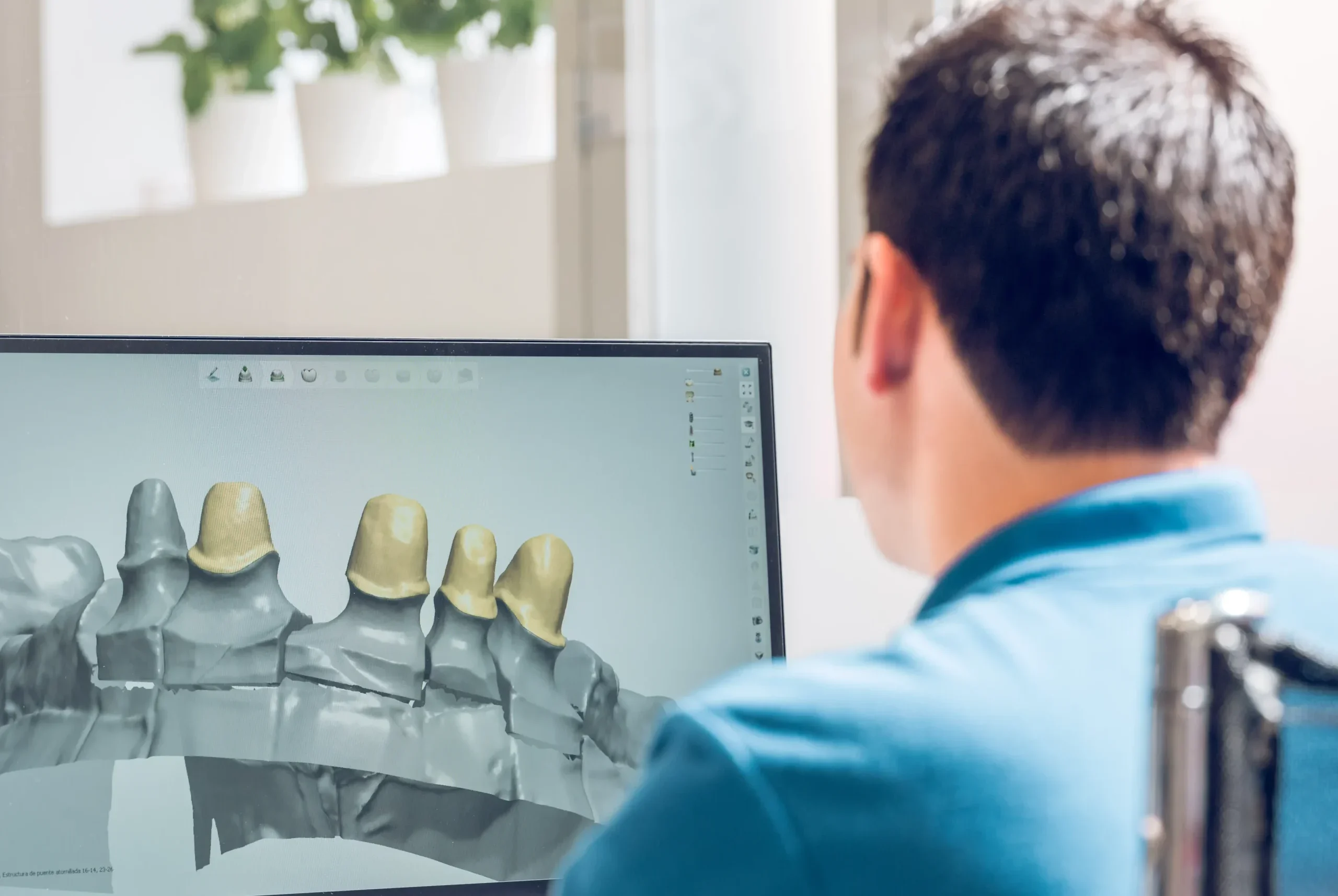 Dentista viendo tratamiento de implante en software