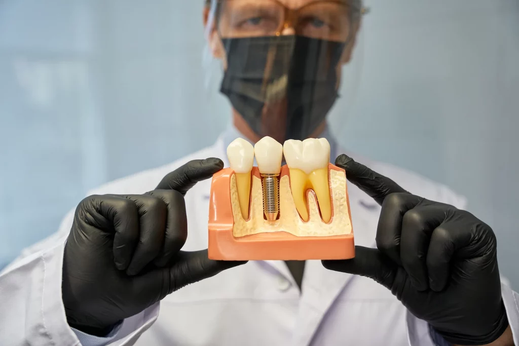 implante-dental